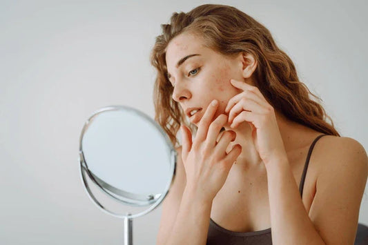 6 Reasons Why You Should Stop Picking Your Pimples (Your Skin Will Thank You)