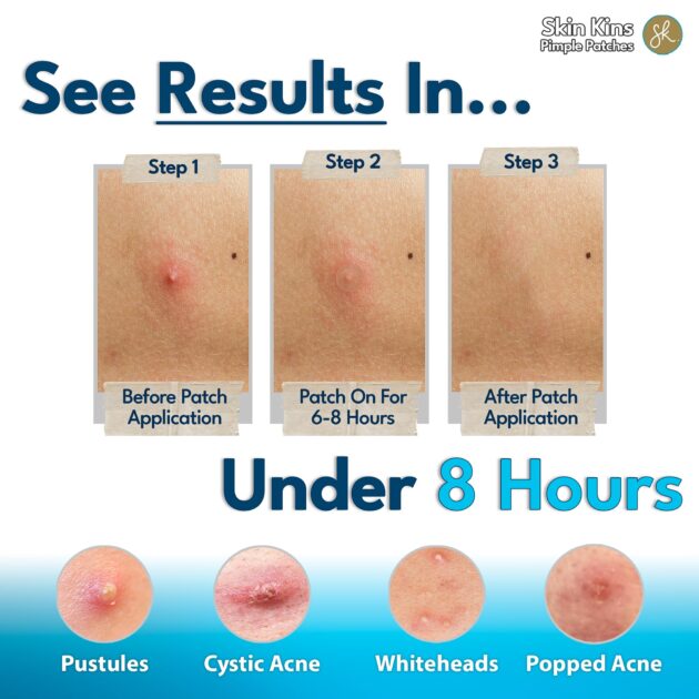 Hydrocolloid Pimple Patches for Face - Ultra-Thin 0.37mm Acne Patch with Centella - Beveled for Stronger Grip - Korean Skin Care Spot Covers - Gunk Out in 6-8 Hrs - Vegan, Made in Korea, 48 Dots - Image 2